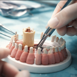 Protesi Fisse e Mobili